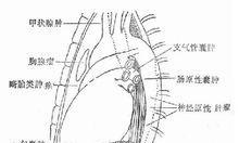 万和热水器故障E9的维修方法（感温探头故障是故障E9的主要原因）