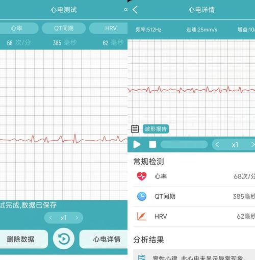 河南品牌健康监测智能手表最新排行榜？哪款更值得购买？